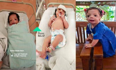 Suri Tasneem Seorang Anak Syurga Seorang Anak Yang Istimewa Mengalami Sindrom Sejak Lahir.